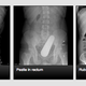 Illustration for article titled The Site Where Doctors Share X-Rays of Weird Things in People's Butts
